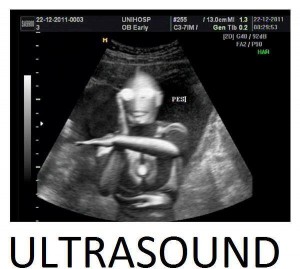ultra